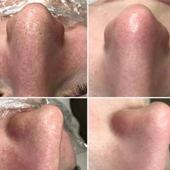 Дарья Рублева, Одеса Фото - 58