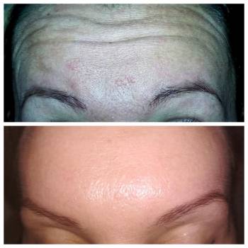 Людмила Нишенко-Зубковская , Бровари Фото - 5