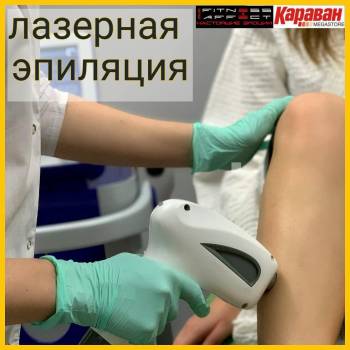 лазерна епіляція