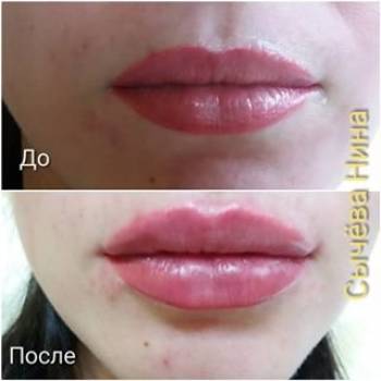 Нина Сычева , Нікополь Фото - 5