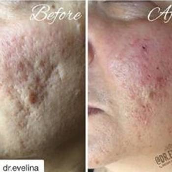 Niagara Spa, Нікополь Фото - 5