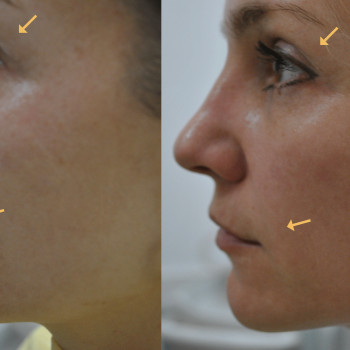 Фото с портфолио Медеско