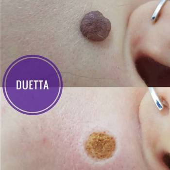 Duetta, Мелитополь Фото - 5