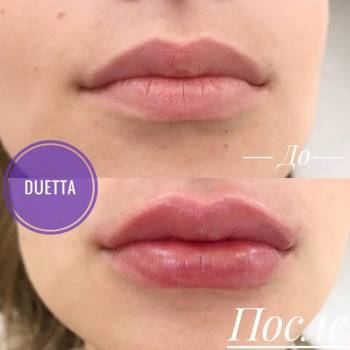 Duetta, Мелитополь Фото - 6