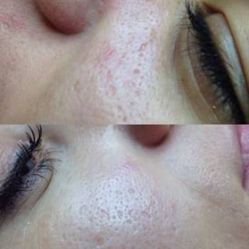 Фото с портфолио De La Rose