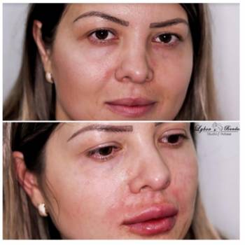 Любовь Бандура , Харків Фото - 4