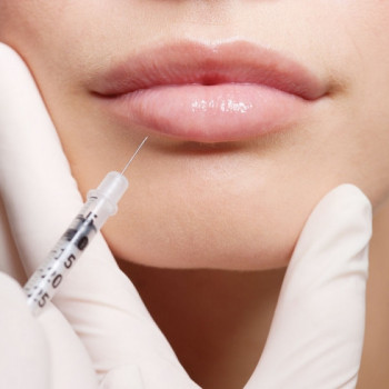 Увеличение губ
                    Косметолог Любовь Бандура Харьков