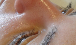 Комбинированная чистка лица Косметолог Юлия Николаев