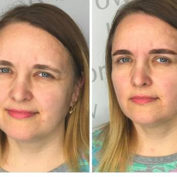 La Belle, Чернігів Фото - 24