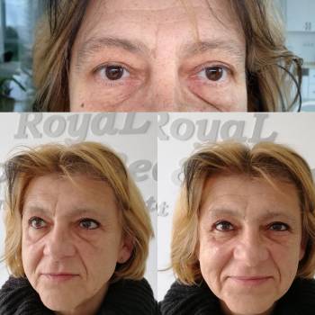 ROYAL Color & Beauty, Ровно Фото - 20