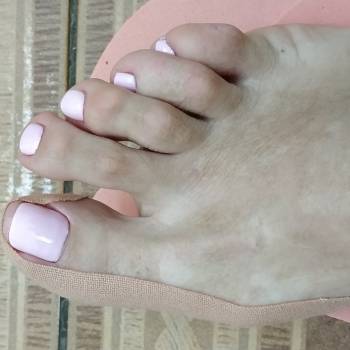 Тейпирование. Отведение большого пальца