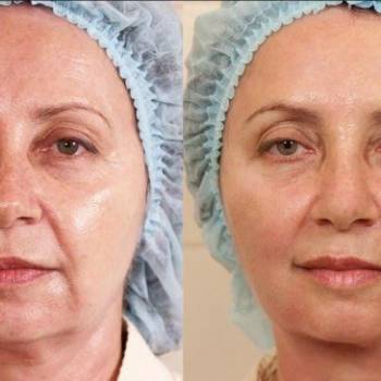 Ирина Ситникова, Киев Фото - 13