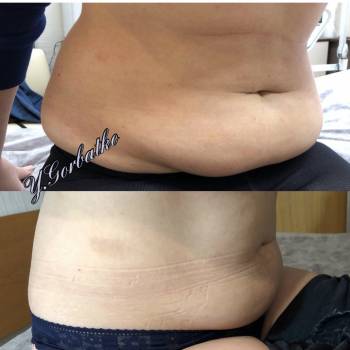 Фото с портфолио Юлія Горбатко