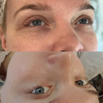 Комплекс "BB GLOW - тональный крем на год"
                    Косметолог Ирина Киев