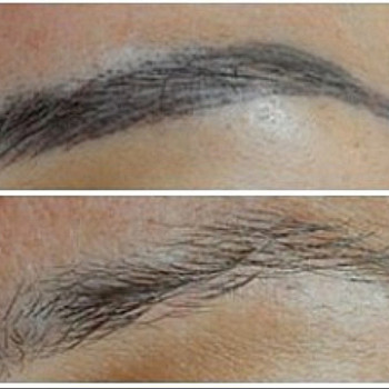 Удаление тату и татуажа
                    Тату салон TST Киев