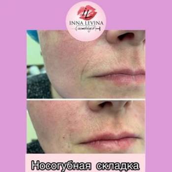 Инна Левина , Київ Фото - 5