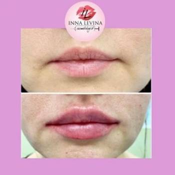 Инна Левина , Київ Фото - 6