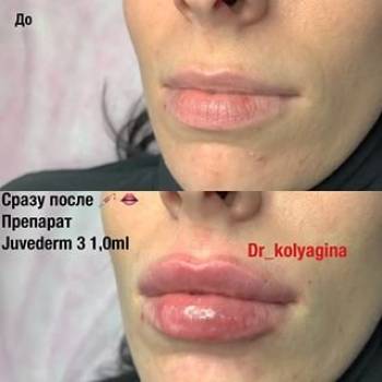 Евгения Колягина , Киев Фото - 6