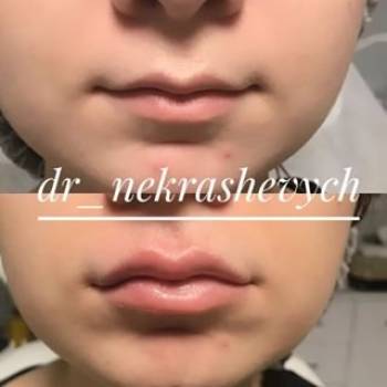 Елена Некрашевич , Київ Фото - 5