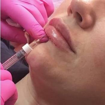 Наталья Чекалова , Киев Фото - 5