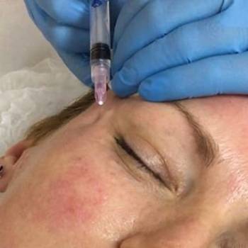 Наталья Чекалова , Киев Фото - 6