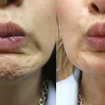 Марина Воробец , Київ Фото - 5