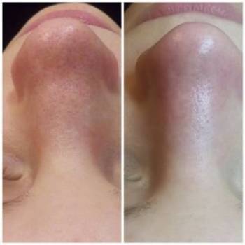 Фото с портфолио Василина Нещерет