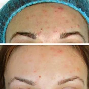 Фото с портфолио Василина Нещерет