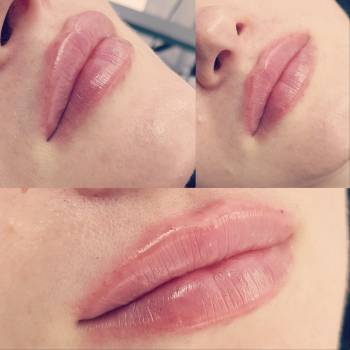 Алла Шиш , Переяслав-Хмельницький Фото - 15