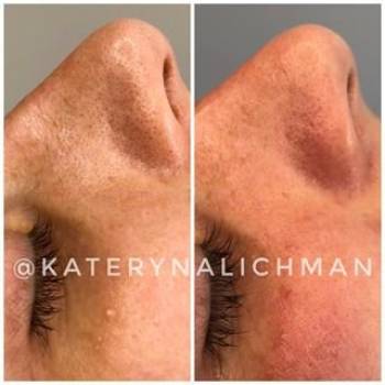 Екатерина Личман , Киев Фото - 6