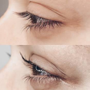 «Ламінування вій + ботокс»
Вигляд збоку