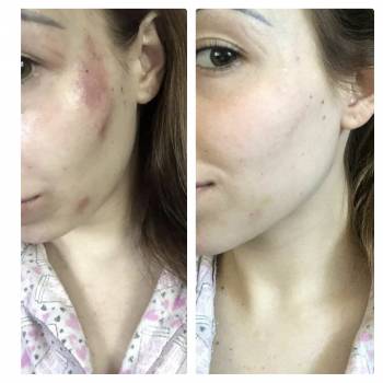 Катерина Зацерковна, Вінниця Фото - 6