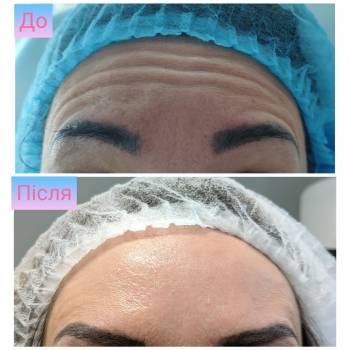 Катерина Зацерковна, Вінниця Фото - 7