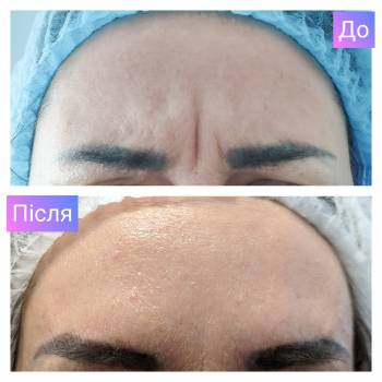 Катерина Зацерковна, Вінниця Фото - 8