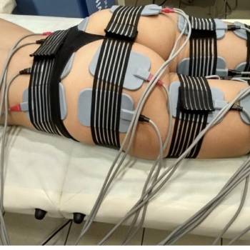 Миостимуляция 