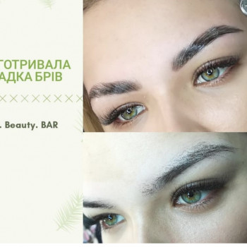 Біофіксація брів