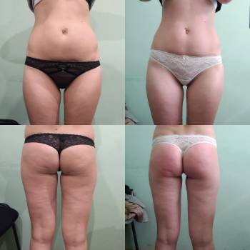 Мирослав Удод, Каменское Фото - 6