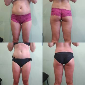 Мирослав Удод, Каменское Фото - 7