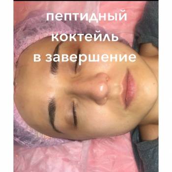 Завершающий этап «Экспресс-процедуры»