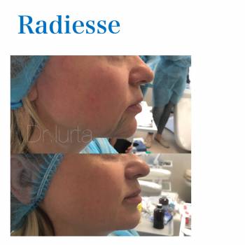 Виталия Юрта , Полтава Фото - 5