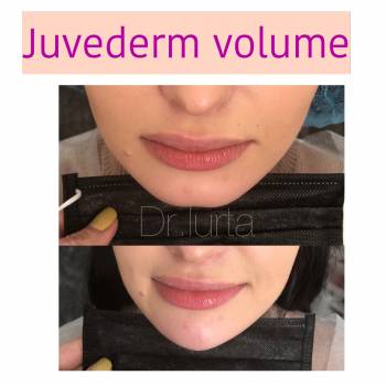 Виталия Юрта , Полтава Фото - 6