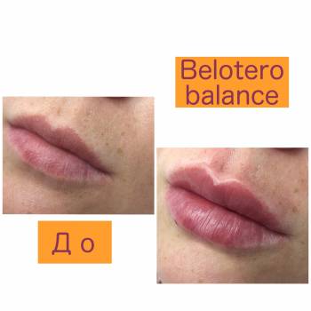 Виталия Юрта , Полтава Фото - 7