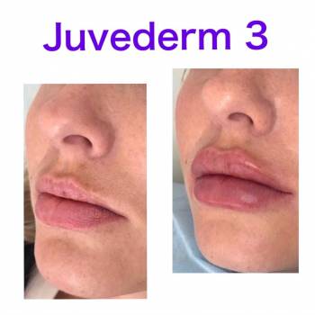 Виталия Юрта , Полтава Фото - 9