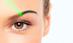Видалення татуажу брів Косметология Beauty Laser Чернигов