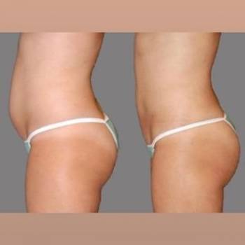 Фото с портфолио Марьяна 