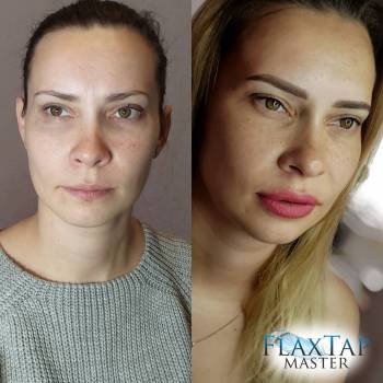 Преображение клиентки! Фото "До" и фото "После" процедур пер