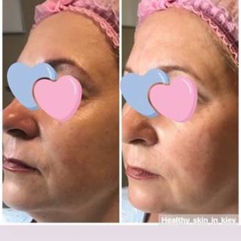 Фото с портфолио Полина Карпушина 