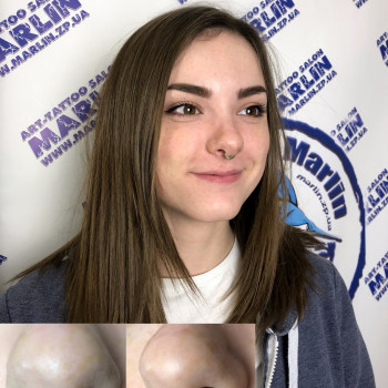 Пирсинг (любой сложности) и микродермалы
                    Тату салон Арт тату салон Marlin Запоріжжя