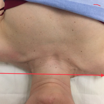 проработана левая сторона