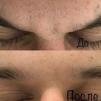 экспресс уход перед важным событием